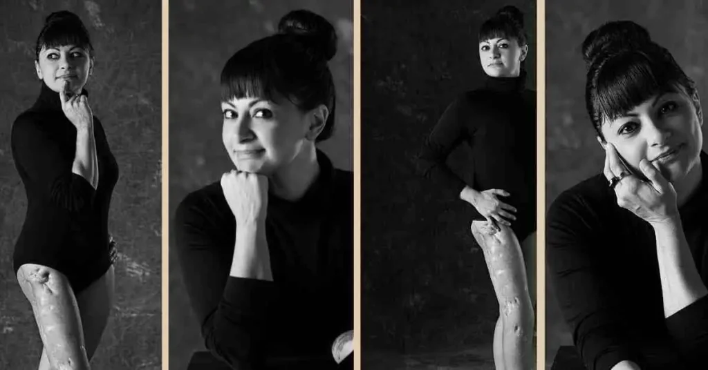 Ho scelto di mostrare le cicatrici 7 Quattro ritratti b/n di donna con cicatrici, in body nero, forte e consapevole